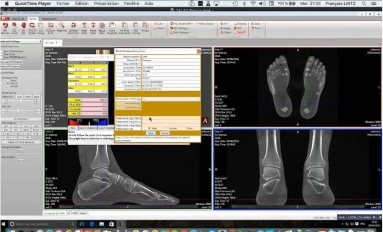 Join The TALAS Revolution in Foot and Ankle Diagnosis - CurveBeam AI