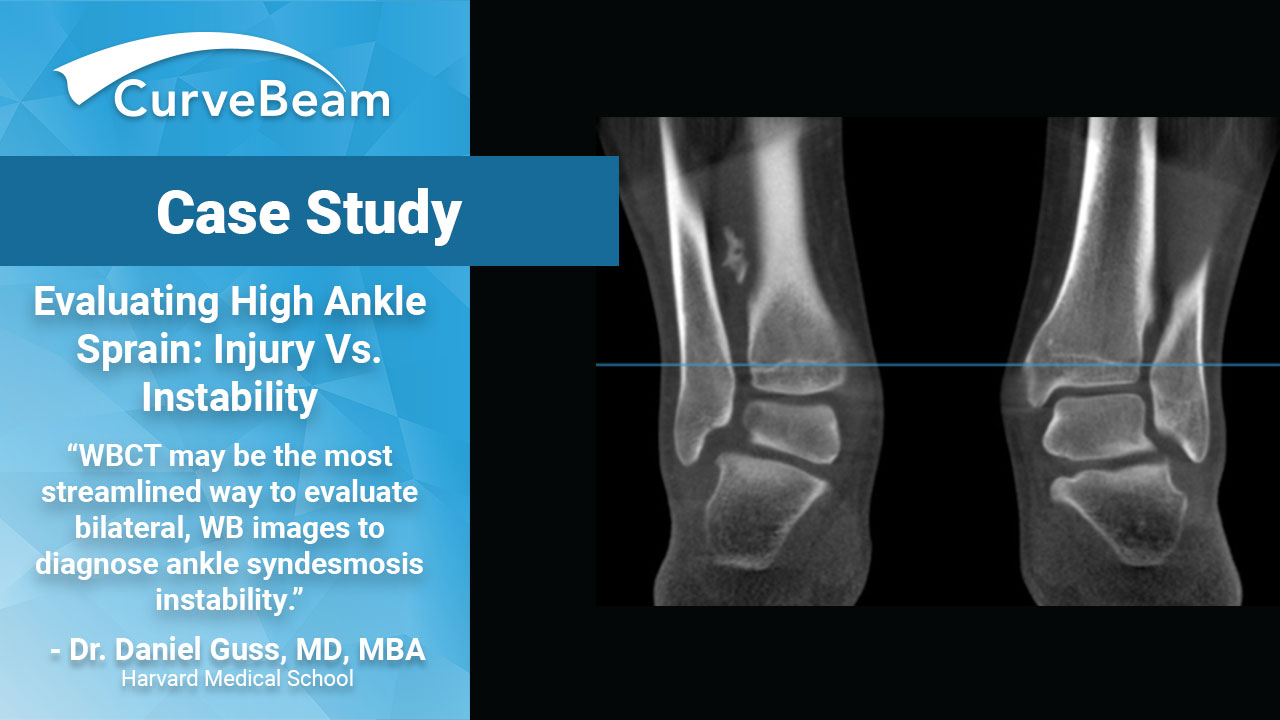 Evaluating High Ankle Sprain: Injury vs. Instability