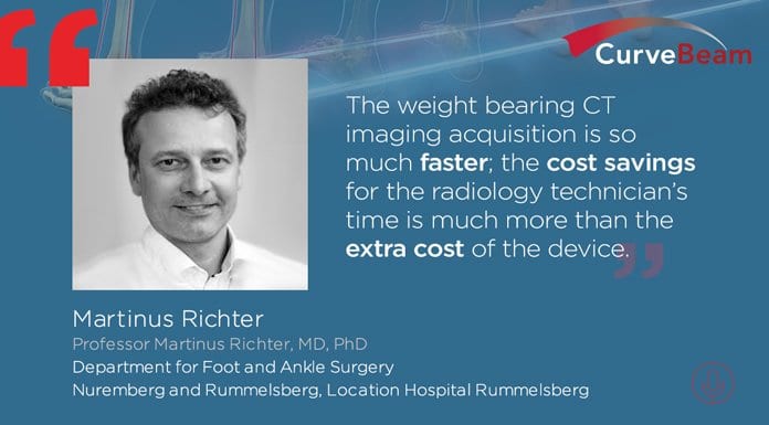 CurveBeam Connect: Breaking Down a New Study on Weight-Bearing CT’s Impact on Cost