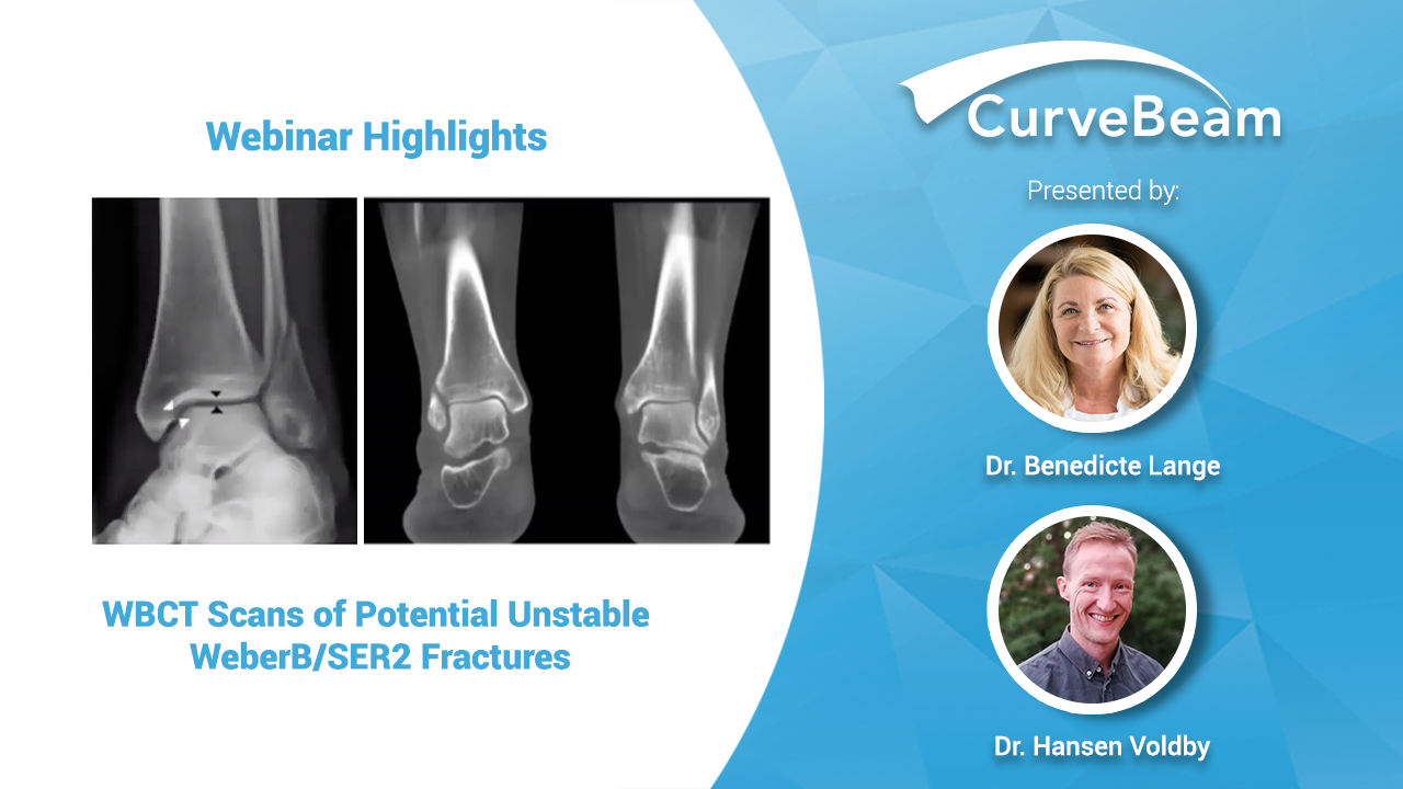 Webinar Recap: WBCT Scans of Potentially Unstable WeberB/SER2 Fractures