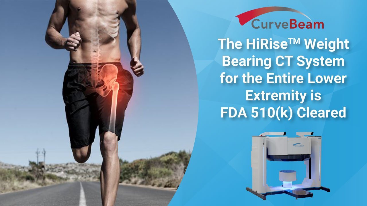 CurveBeam Announces FDA 510(k) Clearance for HiRise Weight Bearing CT System for the Entire Lower Extremity