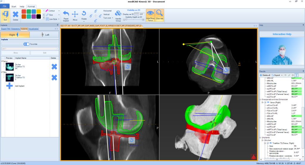 mediCAD CurveBeam