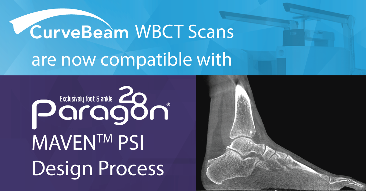 CurveBeam Weight Bearing CT Systems Offer Protocol for Paragon 28’s MAVEN Patient-Specific Instrumentation System