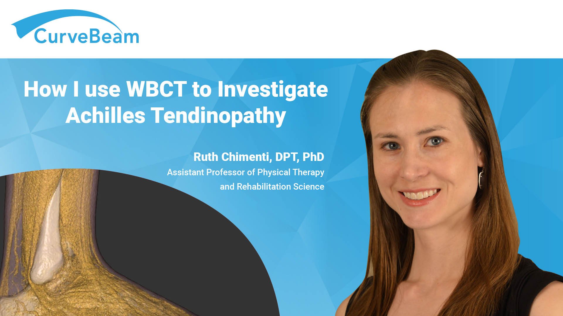 Iowa Researchers Use WBCT to Investigate Achilles Tendinopathy and Affects of Heel Lifts