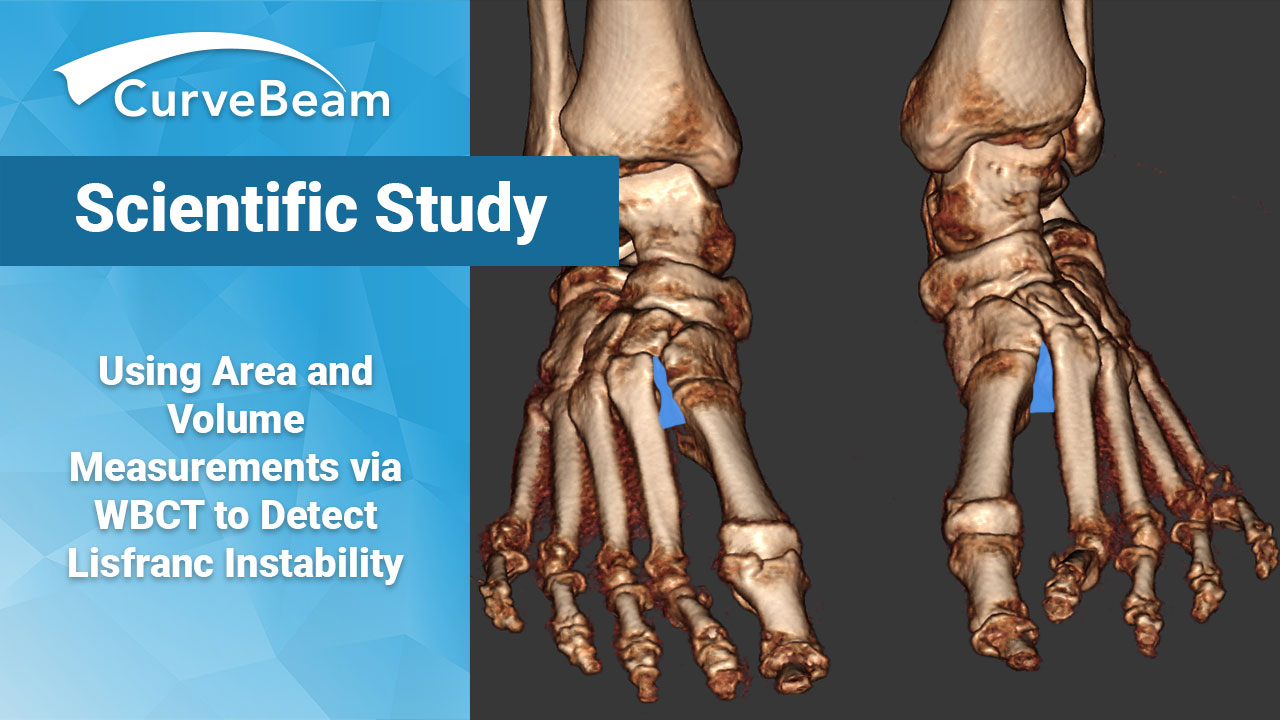 ScientificStudyLisfranc