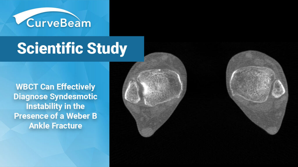 Utility of WBCT to Diagnose Syndesmotic Instability in Patients with ...