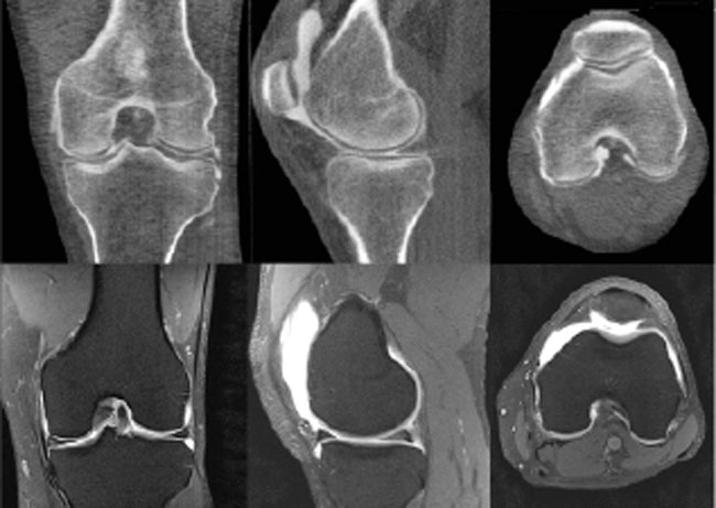 Match-with-MRI