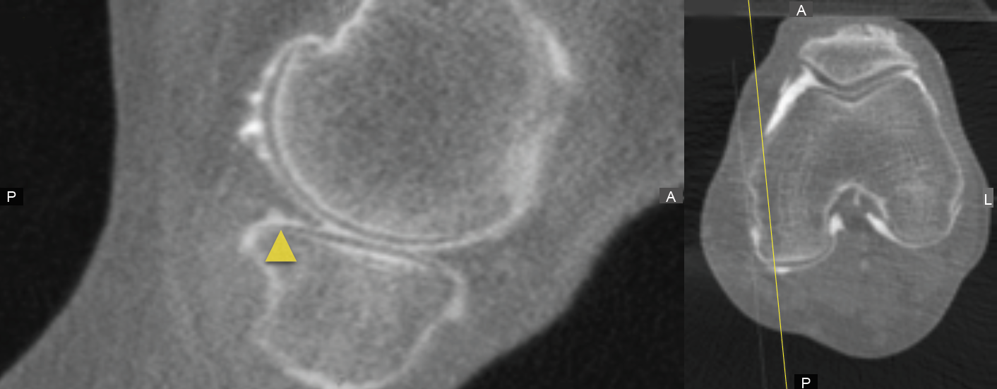 SegalCaseStudySlices