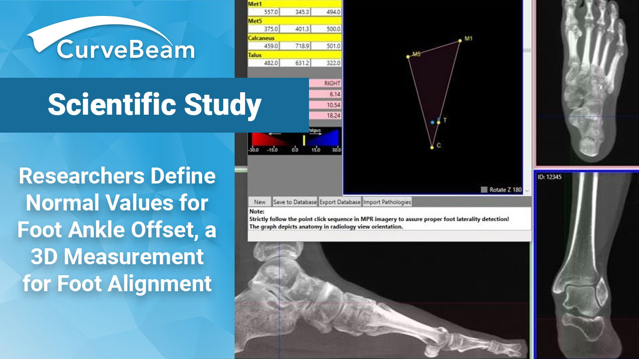 WBCT Helps Define Safe Zone of FAO in Hindfoot Alignment Assessment