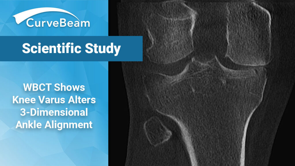 WBCT Study Shows Knee Varus Alters Three-Dimensional Ankle Alignment in ...