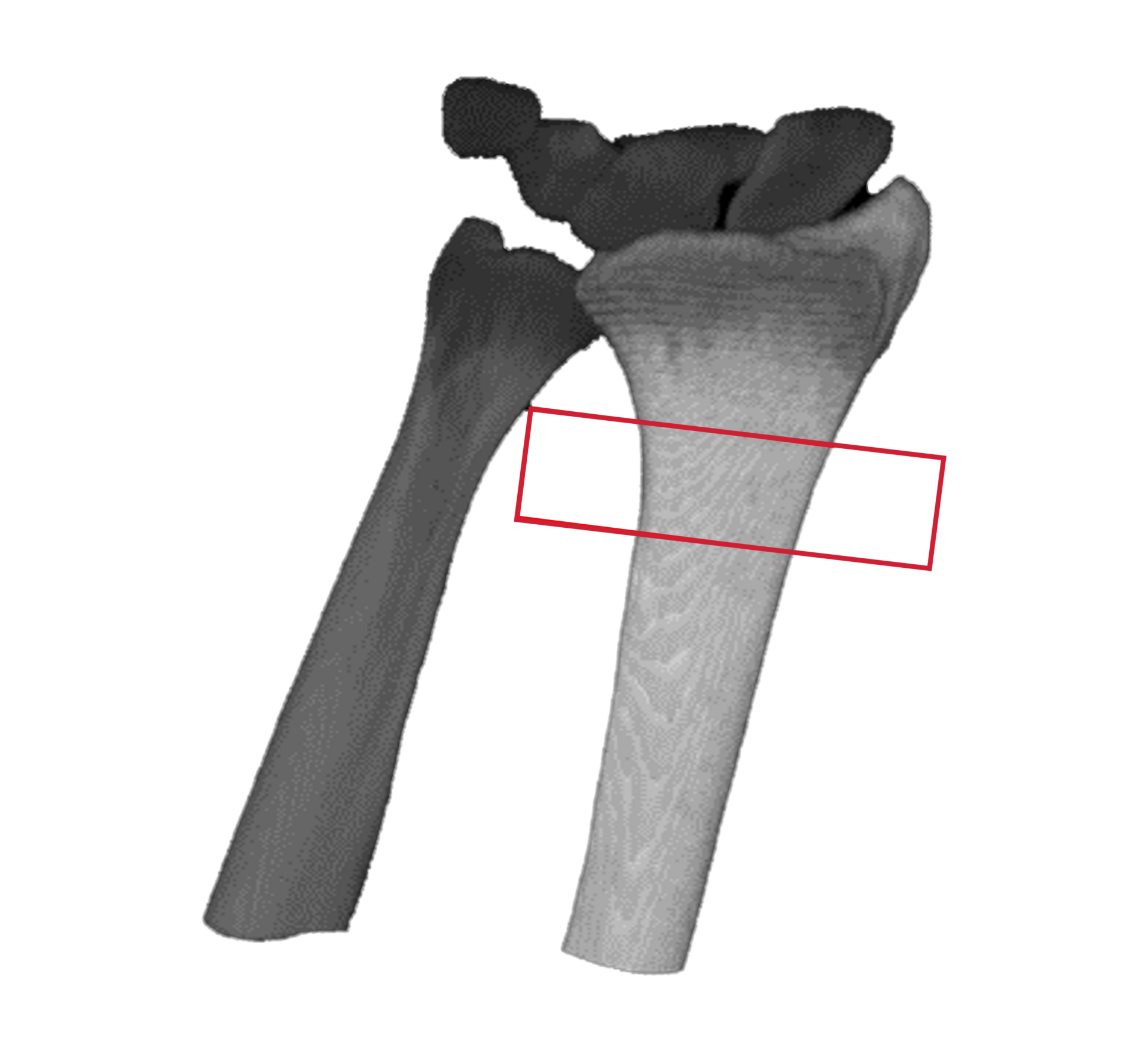 3D-Bone-Extraction-Web2