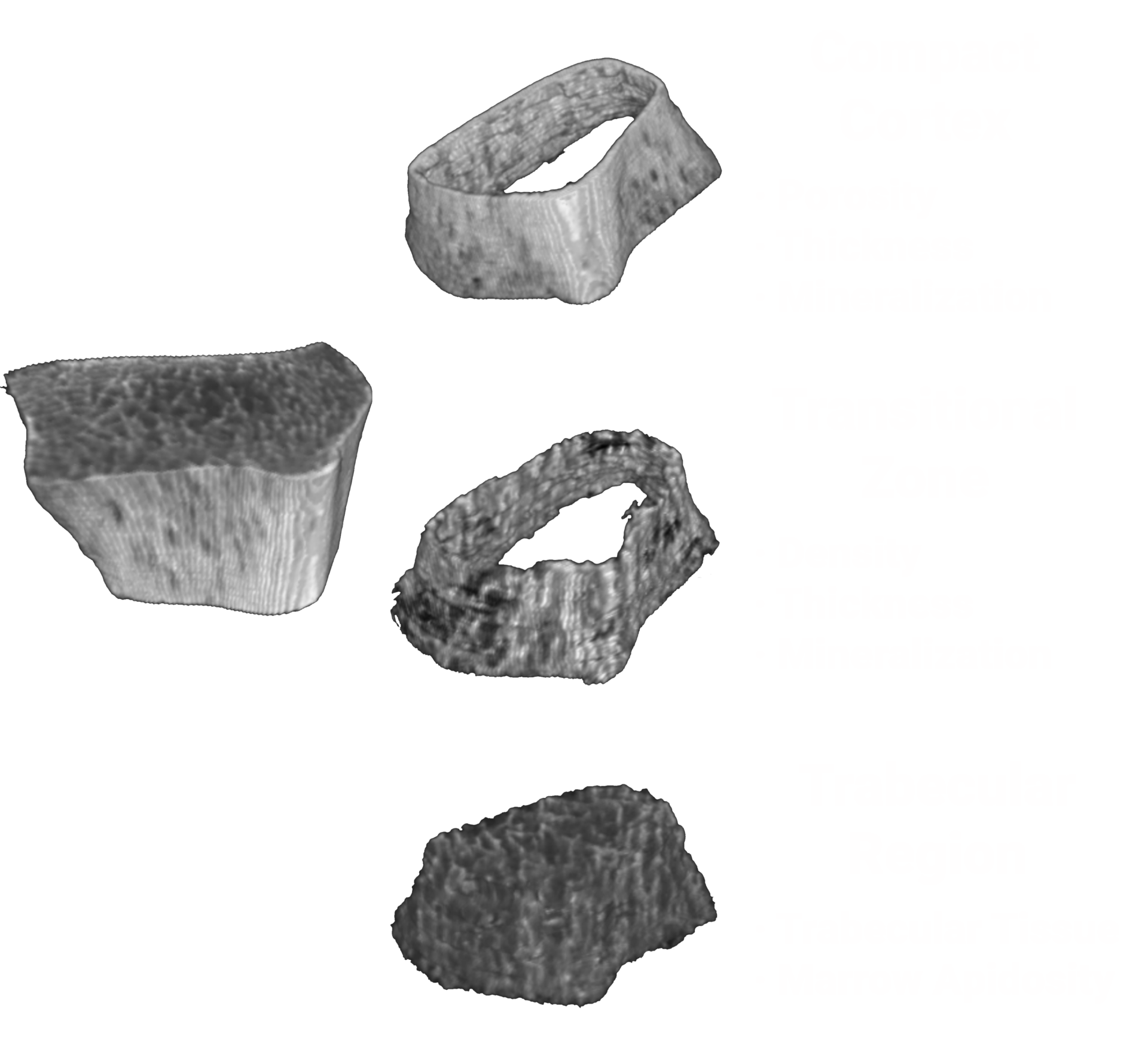 Bone-Micro-SegmentationV2