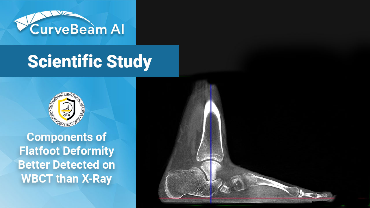 WBCT Better Detects Complexities of Flatfoot