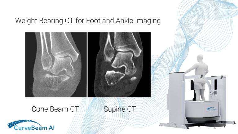 Weight Bearing CT for Foot & Ankle Imaging - CurveBeam AI