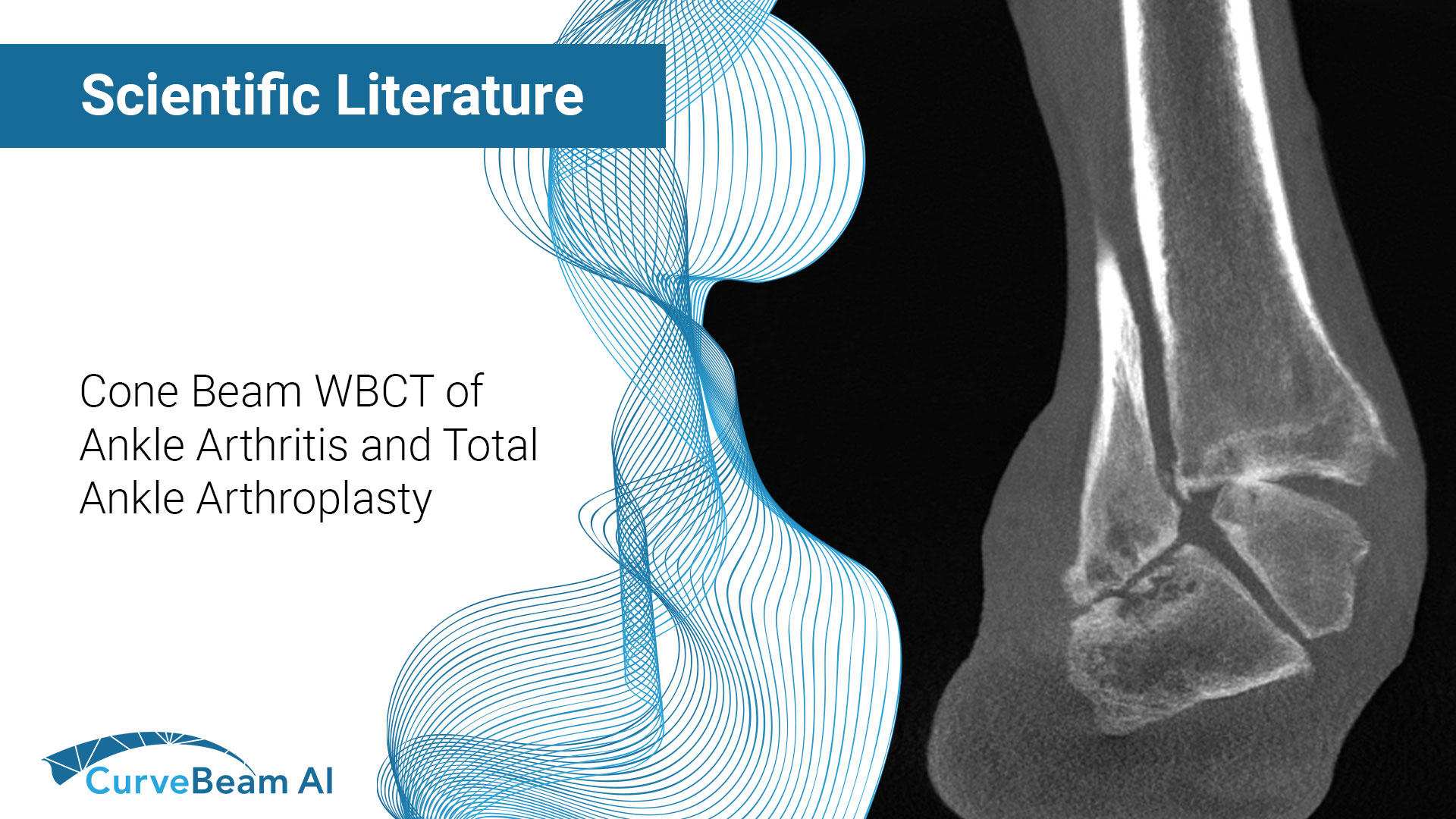 CB-WBCT-Ankle-Arthritis