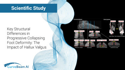 PCFDHalluxValgusStudy